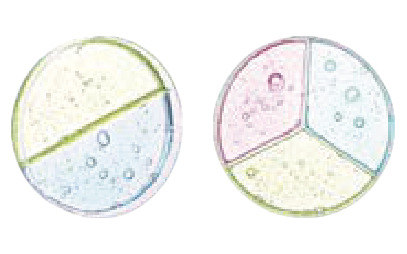Bacterial culture dishes – single, 2-well and 3-well (photo)