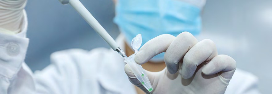 Pipetting a plasmid sample (photo)
